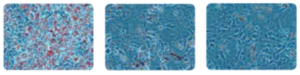 LIPOREDUCTION