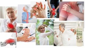 doloarthritis